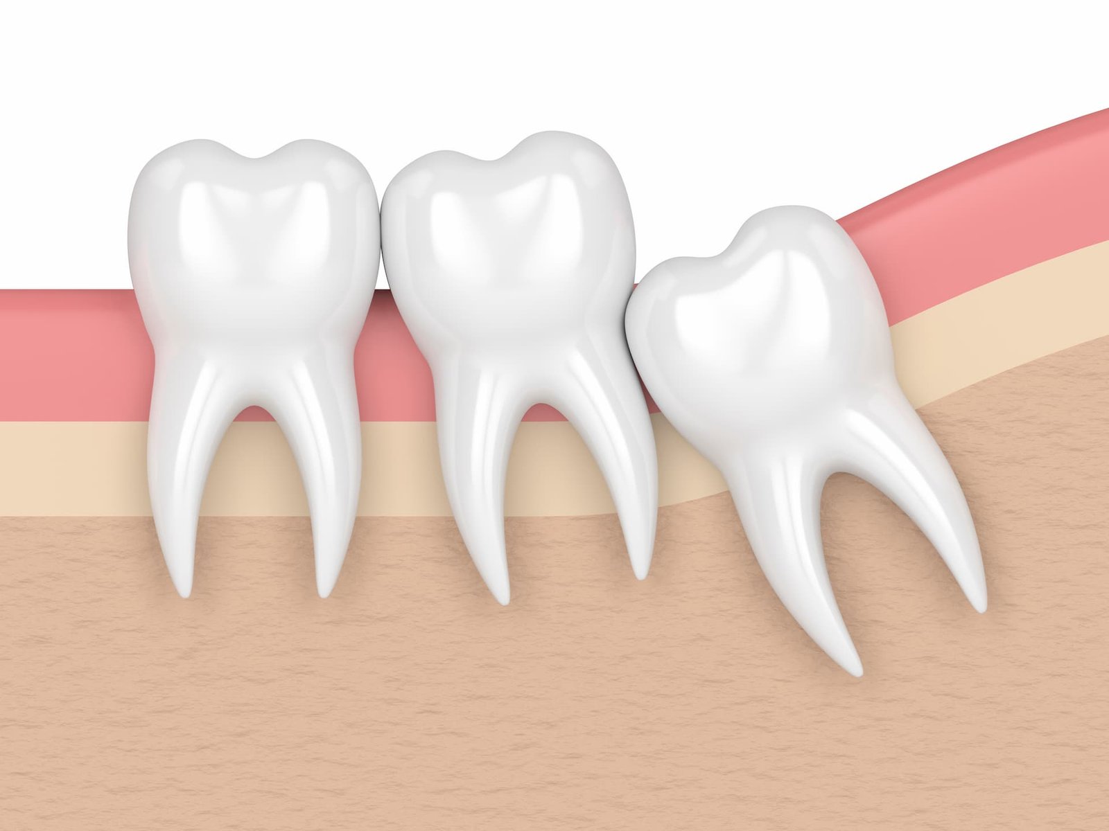 CIRUGIA BUCAL | Clínica Dental Arabial